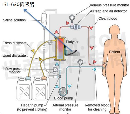 【应用"即剥即贴"超声波液位传感器sl-630,满足血液透析时非接触式